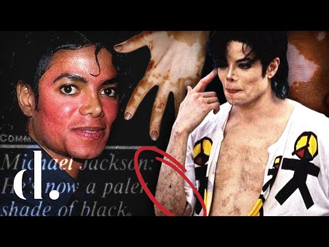 A DEEP Analysis of Michael Jackson’s Changing Skin Tone! | the detail.