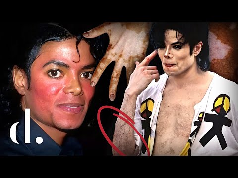 A DEEP Analysis of Michael Jackson’s Changing Skin Tone! | the detail.