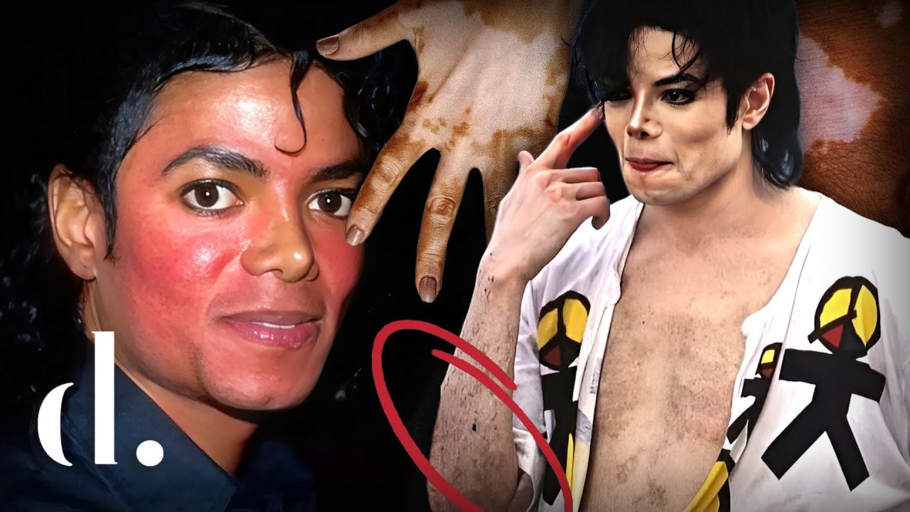 Watch A Deep Analysis of Michael Jackson’s Changing Skin Tone | the detail. now A Deep Analysis of Michael Jackson’s Changing Skin Tone | the detail.