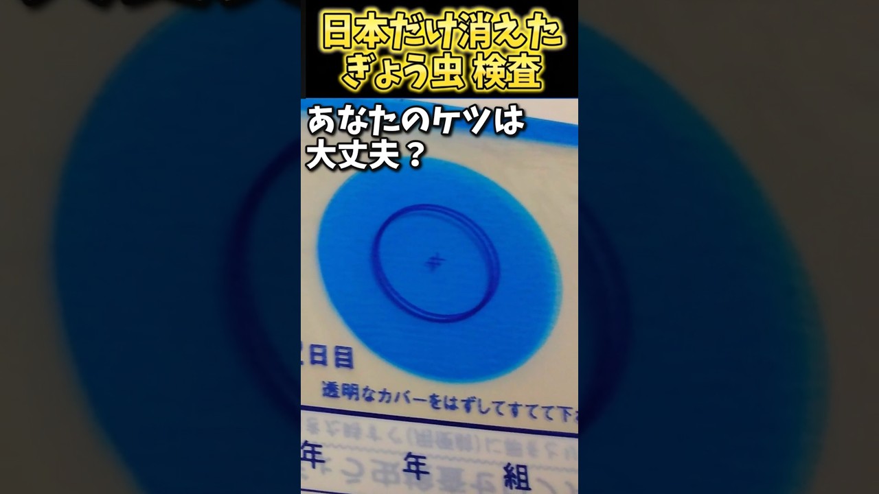 日本、ぎょう虫検査を廃止してしまう