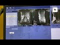 Mri Abdomen Ge 3T