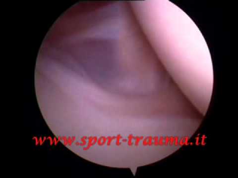 Re TURP Medicina prezzo prostanorm