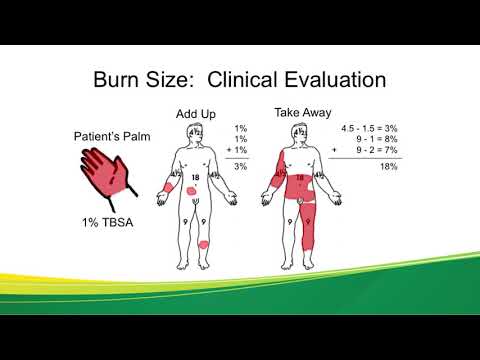 Acute Burn Injuries - Dr. Kwan
