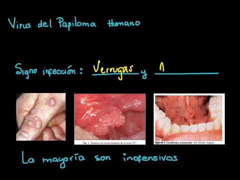 Papilloma virus copii
