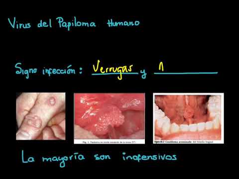 papillomavirus benigno