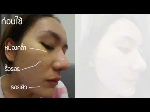 คลิกเพื่อดูคลิปวิดีโอ