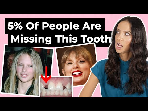 Born With Missing Teeth? (Hypodontia)
