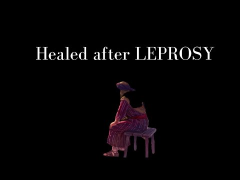 Leviticus 14 | Part 1 | Laws of Leprosy in detail