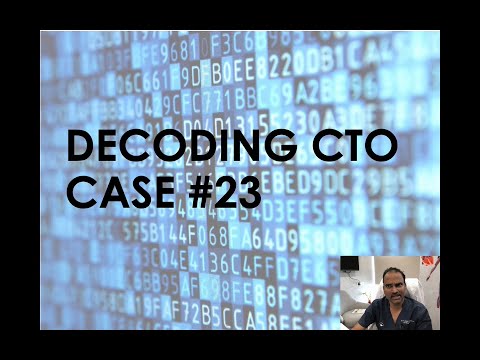 Decoding CTO Case - 23 | Uncrossable Retrograde Corsair In Anamolous RCA CTO