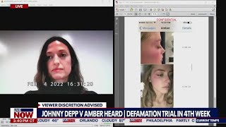 Johnny Depp-Amber Heard: Witness questioned about redness photos | LiveNOW from FOX