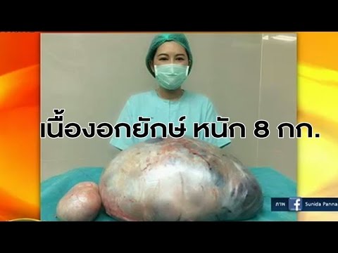 หญิงเชื้อโรคคิดเห็นเคี้ยวเอื้อง สิ่งที่ดูเหมือนอ่อนแอ