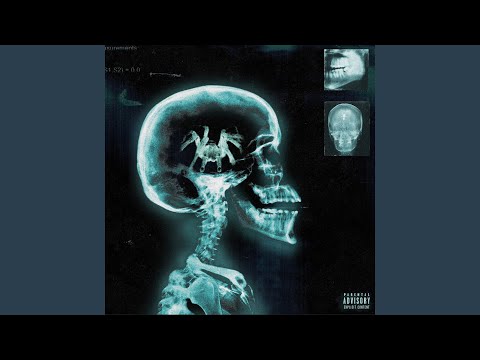 Paraplegic (feat. Woop)