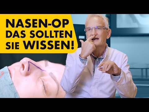 5 Dinge, die sie VOR einer Nasen-OP wissen sollten! (mit OP-Video) | Nasenkorrektur Dr. Jungwirth