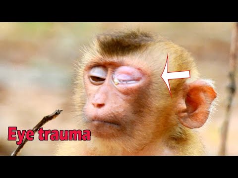 Break news break heart !orphan abandon little poor monkey SOK was got severe eye trauma nearly blind