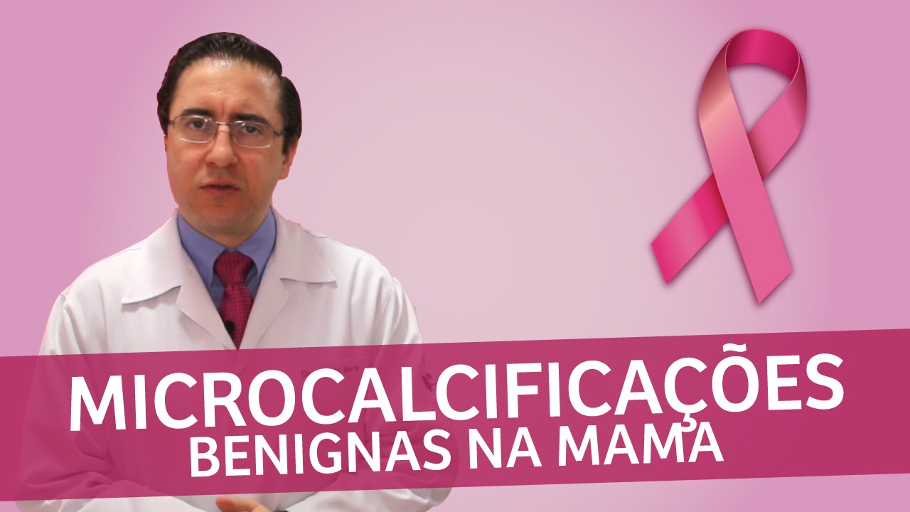 Microcalcificações benignas na mama | IMEB
