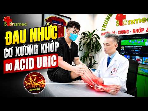  Đau Cơ Xương Khớp Do Acid Uric? Đừng Để Khớp Biến Dạng!