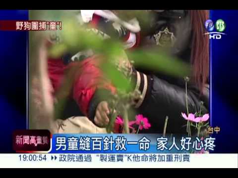 野狗發狂圍攻 撕咬2歲童縫百針