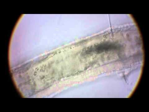 Detritus worm (high magnification)