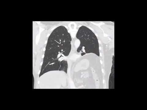 Fernando Espinoza Mercado-32