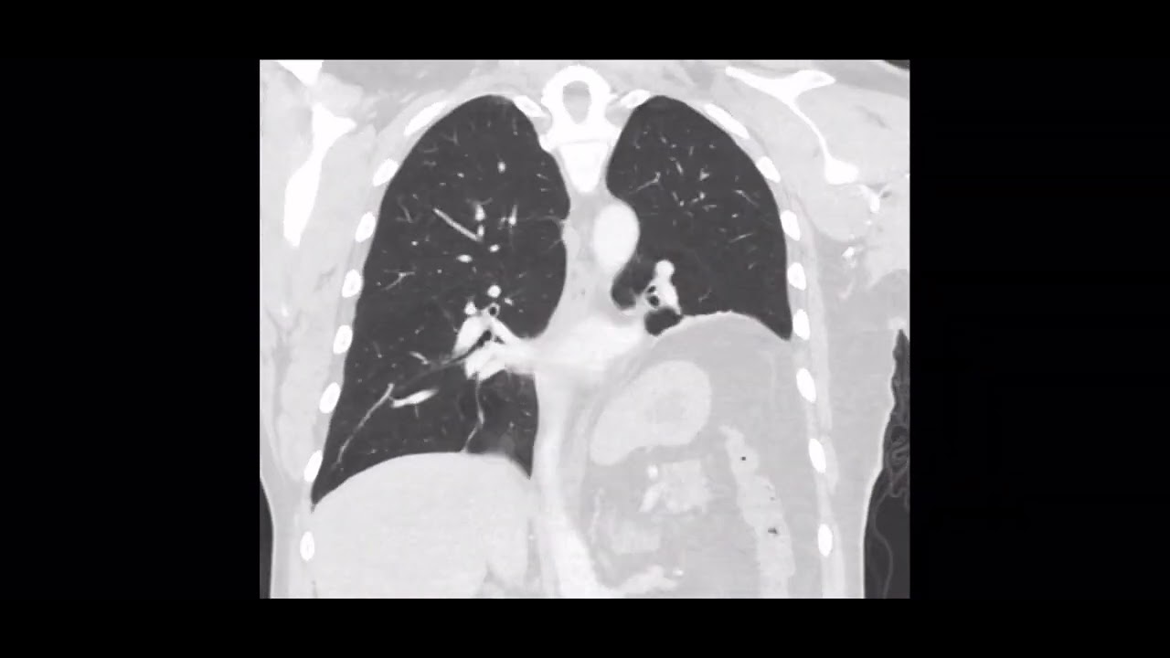 Fernando Espinoza Mercado-32