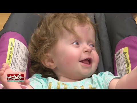 Rare brittle bone disease