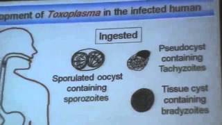 Dr Azaa 10   Toxoplasmosis   YouTube