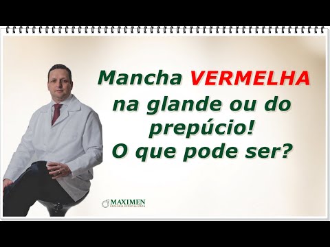 Manchas vermelhas no prepúcio e na cabeça peniana
