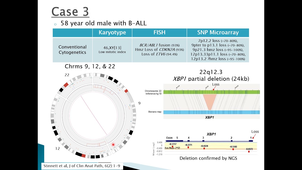Adoption of Optical Genome Mapping in Clinical Cancer Cytogenetic Laboratory: a Stepwise Approach