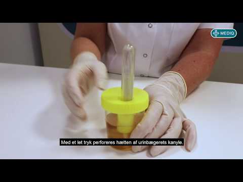 Steril og hygiejnisk urinprøvetagning