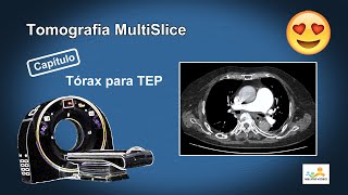 Tomografia Angio de Artérias Pulmonares (TEP)