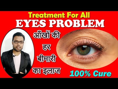 Cure For all eye Problems | Improve your eyesight & get rid of Spectacles आँखों की हर बीमारी का इलाज Video