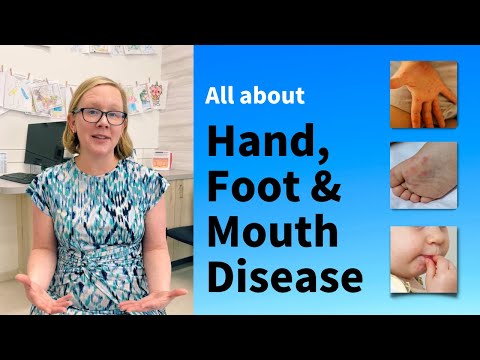 All about Hand, Foot, and Mouth Disease in children and adults