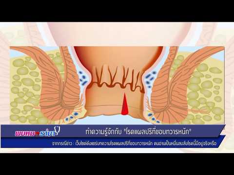 เรียกคืนความแข็งแรงใน 70 ปี ชายแรงอาหาร