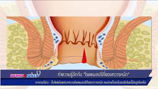 ทำความรู้จัก 