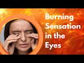 Burning Sensation In The Eyes - EXPLAINED! | Dr. D'Orio Eyecare