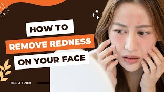 HOW TO REMOVE REDNESS ON YOUR FACE