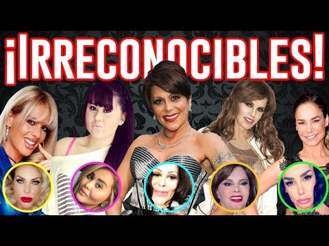 10 famosas irreconocibles ¡el cirujano les arruinó la vida!