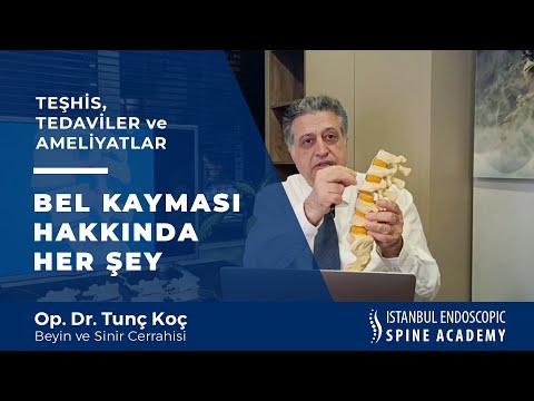 Bel Kayması Hakkında Her Şey