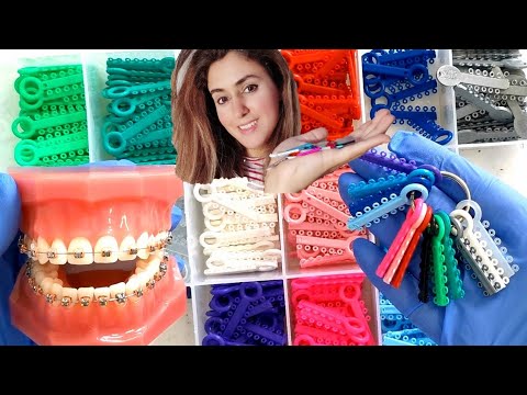How To Choose The Correct Brace Color(s) For You!