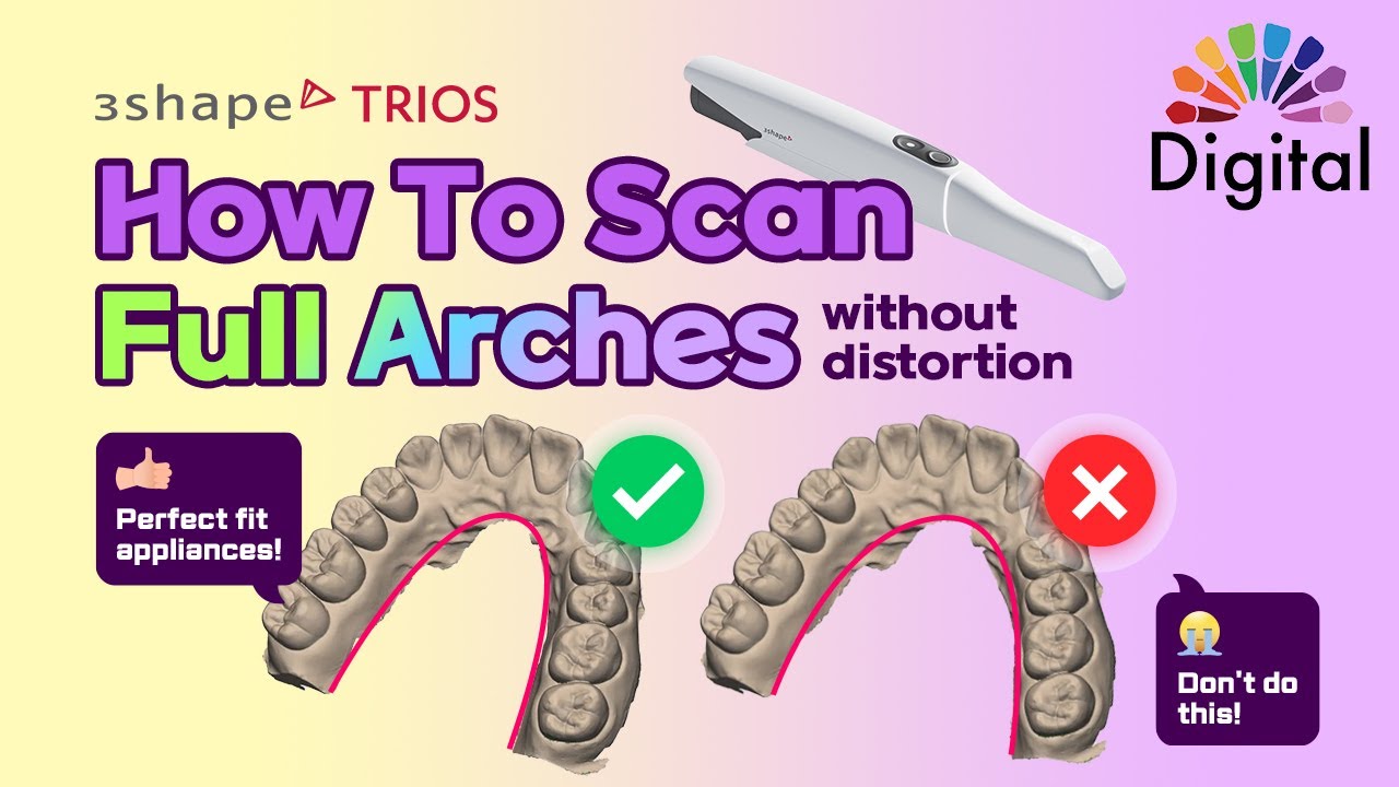Digital Highlight - Full Arch Scanning Tips For Perfect Appliance Fit