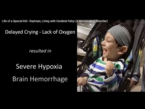 Never Loose Hopes | Believe | Achieve | Life of a Special Kid - Rayhaan, Living with Cerebral Palsy