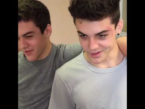 Why'd you say it twice? | Logan Paul Vines | Bestofshorts #shorts