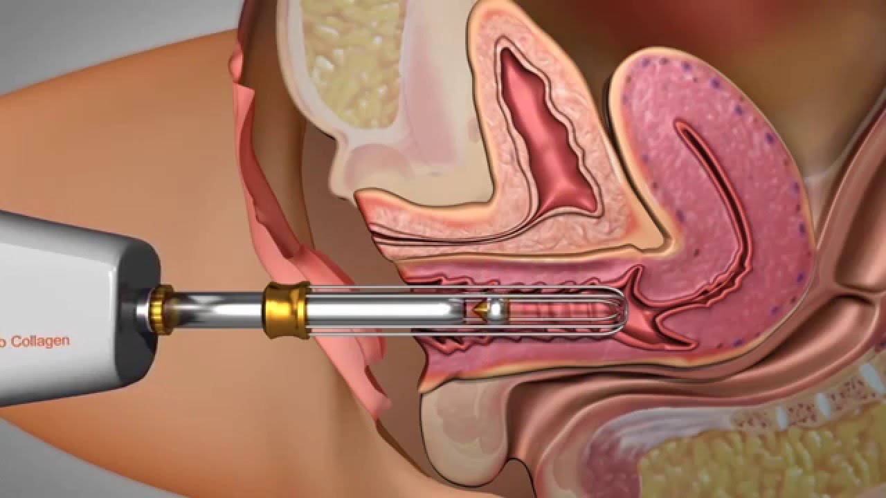 Daniella De Grande Curi-7