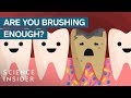 Here S What Happens If You Stopped Brushing Your Teeth