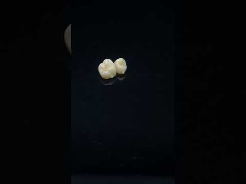 YouTube 썸네일