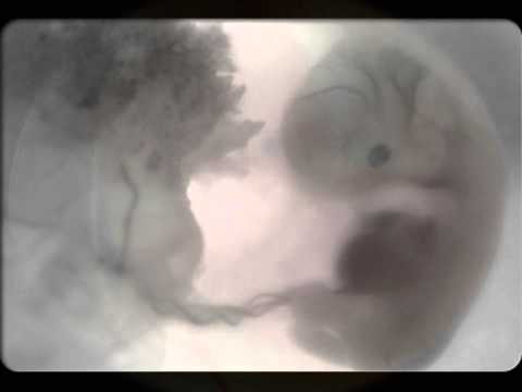 Plague Plenty-Freedom(2011)