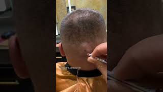 Ingrown hairs #shorts #skincare #hair