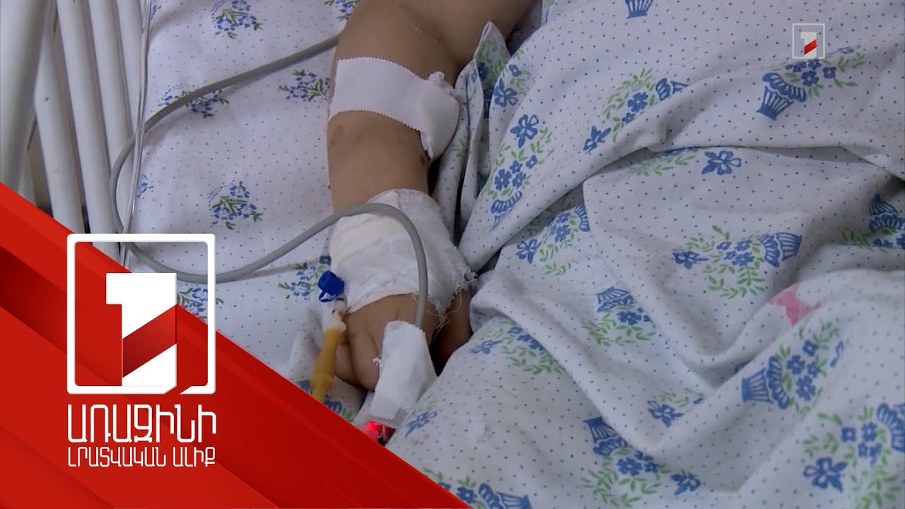 Ամռանը գլուխ են բարձրացնում աղիքային հիվանդությունները. հետևեք հիգիենայի կանոններին. բժշկի հորդորը