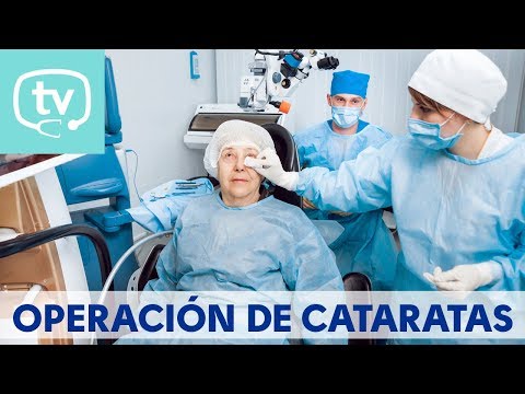 Operación de catarata con lente trifocal