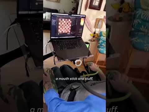 First patient with brain chip implant plays online game of chess Shorts